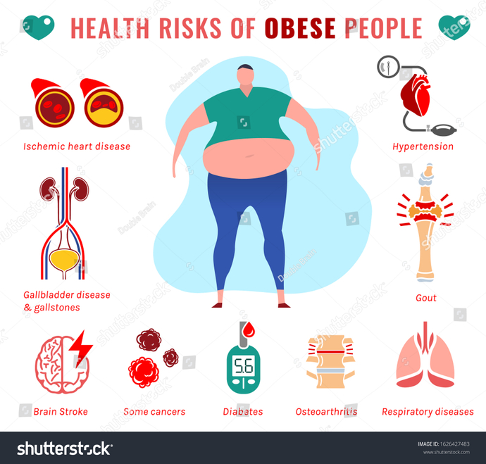 The Obesity rates in America makes Universal Healthcare unaffordable. Do you agree?