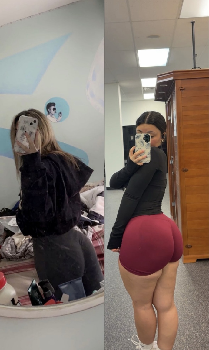 Before or after look healthier?