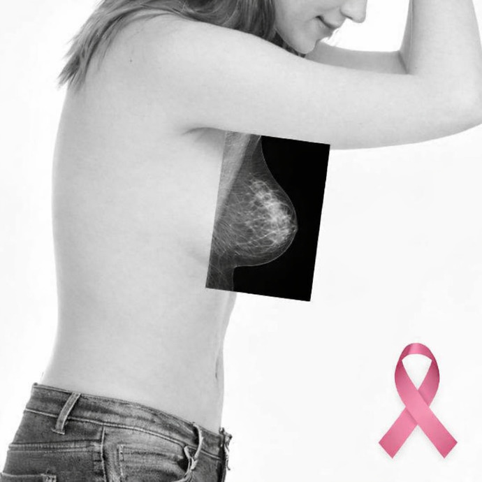 Girls, do you ever worry about having breast cancer?