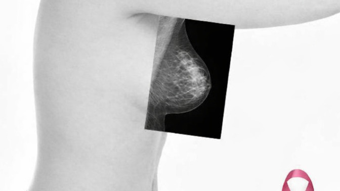 Girls, do you ever worry about having breast cancer?
