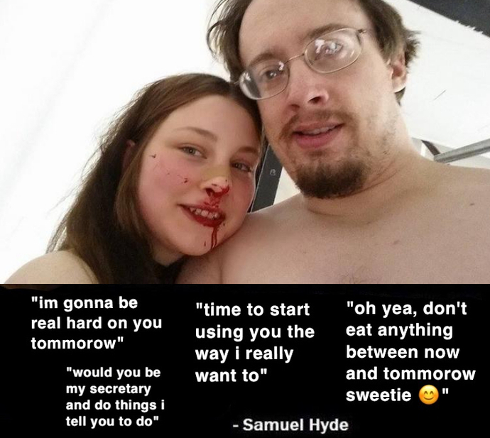 My husband drink 4 cans of beer every day, is it too much?