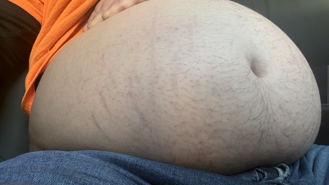 How long dose it take for stretch marks to disappear when losing weight these have been visible for 10 months now?