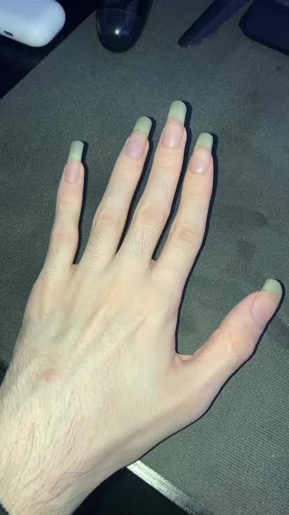 Do you find long fingernails attractive on the opposite sex?