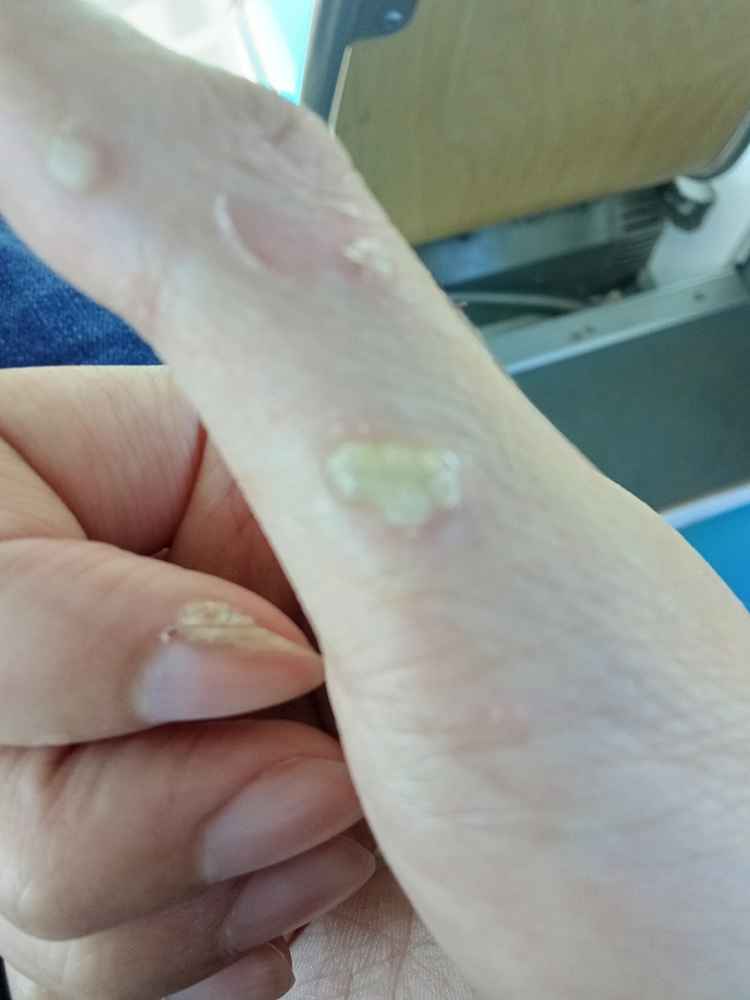 What is this illness?