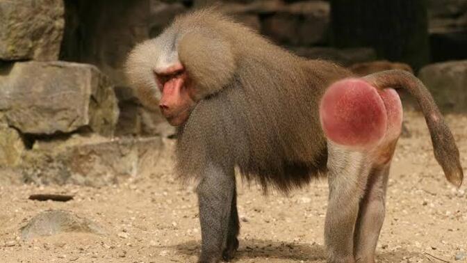 Why is there an epidemic of women with fake buttocks?