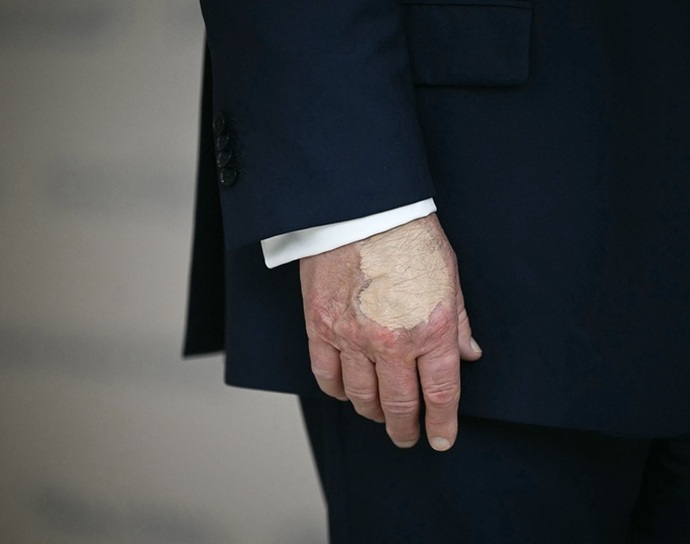Trump is rotting. Why?