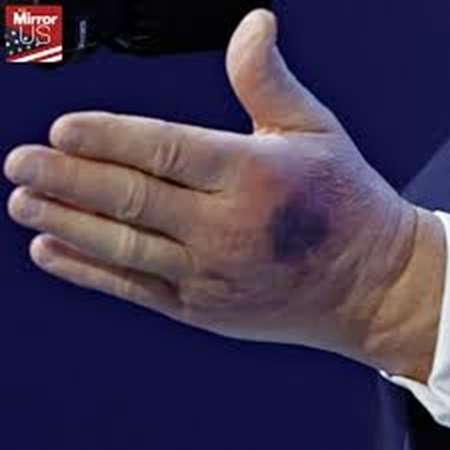 Trump is rotting. Why?