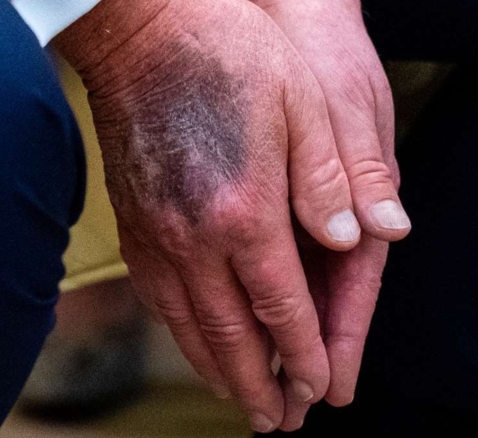 Trump is rotting. Why?