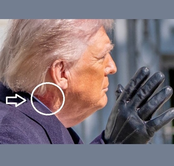 Trump is rotting. Why?