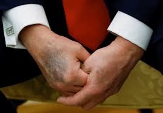 Trump is rotting. Why?