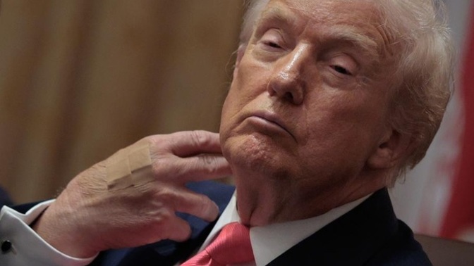 Trump is rotting. Why?