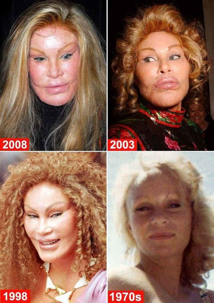 Girls, would you ever consider getting plastic surgery and why?