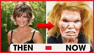 Girls, would you ever consider getting plastic surgery and why?