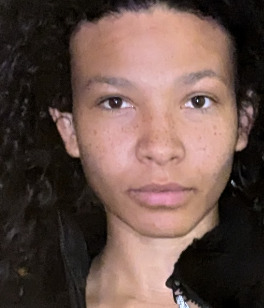 Girls, would you ever consider getting plastic surgery and why?