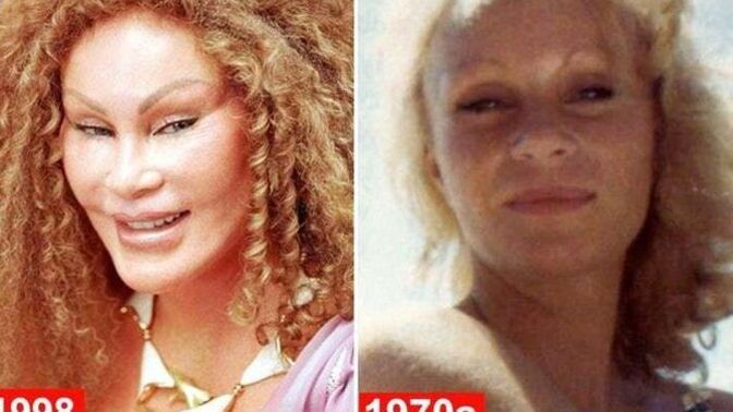Girls, would you ever consider getting plastic surgery and why?