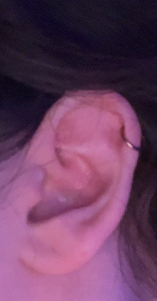 Which ear piercing should I get next to complement my lobe and helix?