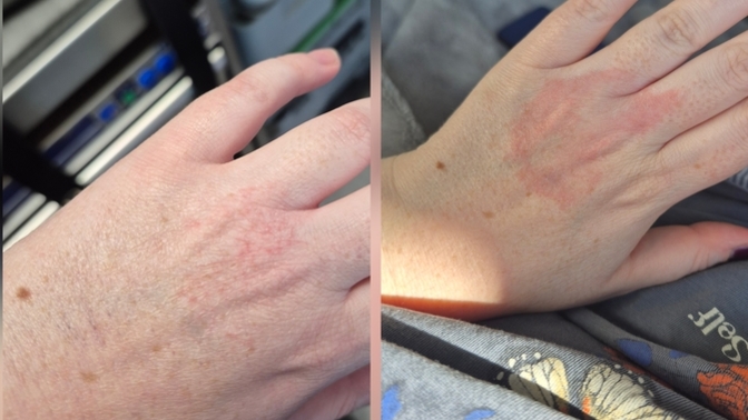 What do you think my dr is going to do now?