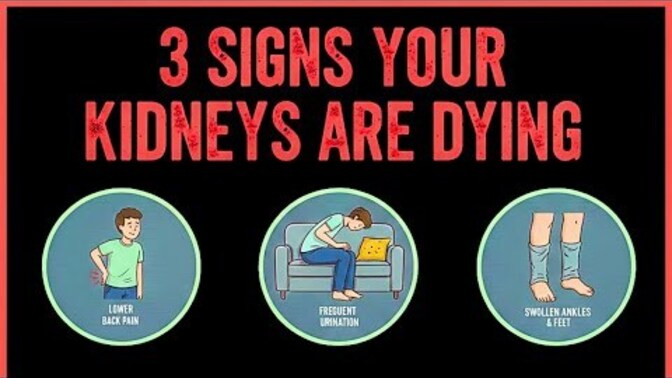 3 Signs Your Kidney's Are Dying. Please know these signs because you want to stay healthy don't you?