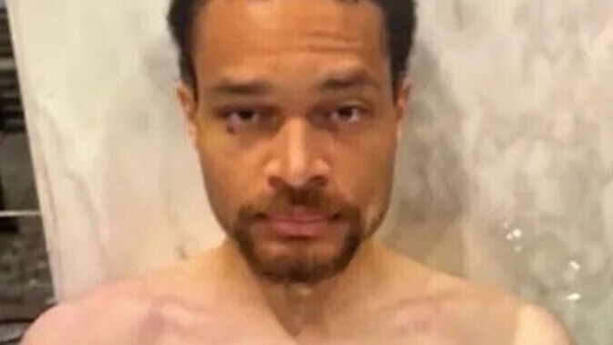 Why is this man naked?