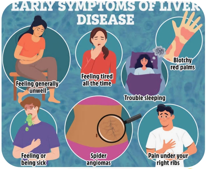 Do You Know You Can Prevent Liver Disease?