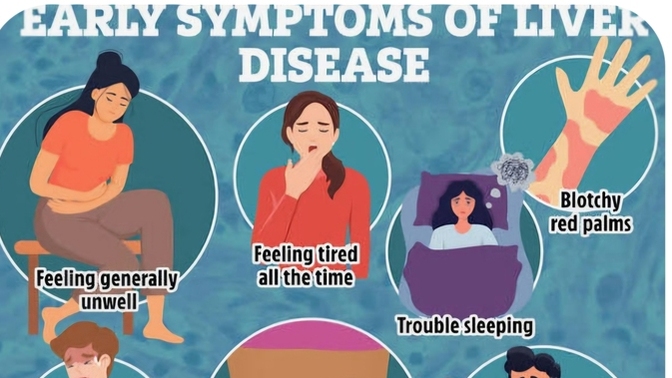 Do You Know You Can Prevent Liver Disease?