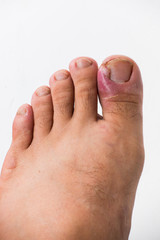 Ouch!