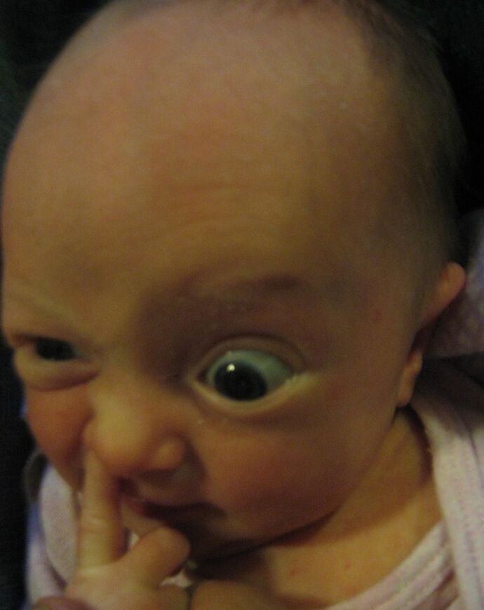 Would you be upset if your partner hid a nose job and baby had a hooked nose?