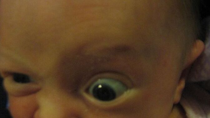 Would you be upset if your partner hid a nose job and baby had a hooked nose?