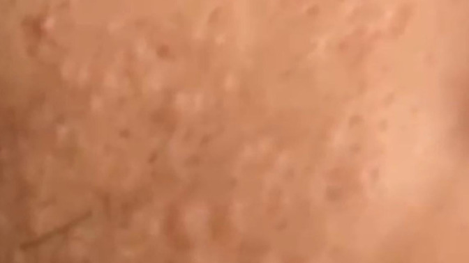 What skin condition is this?