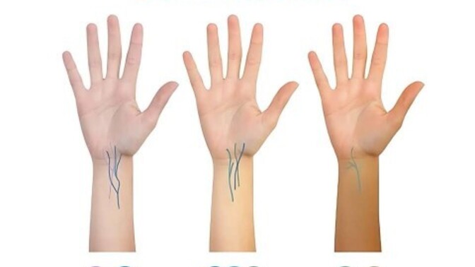 What Color Do Your Veins Show Under The Light?