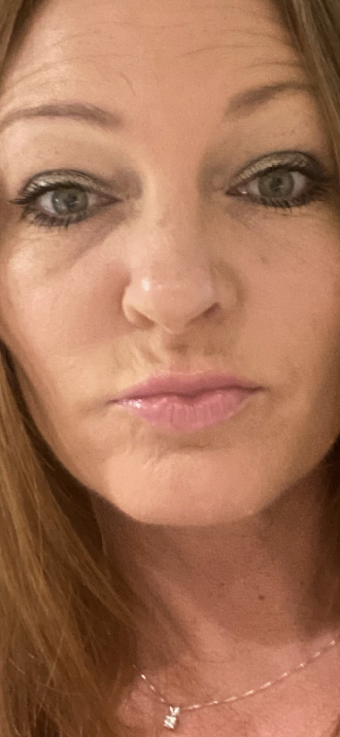 I have dark skin and dislike my eye color, what color contacts suit me?