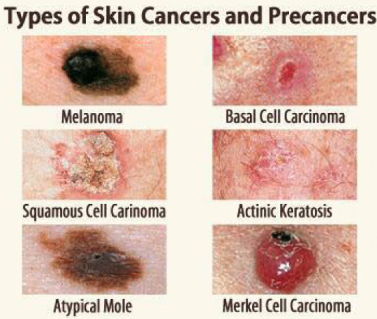 Does This Look Like Cancer To Anyone?