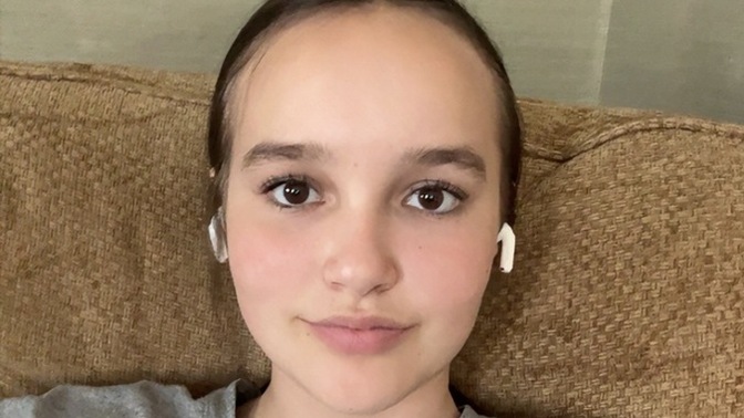 Is my big forehead really unattractive and a turn off for guys?