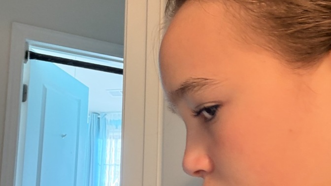 I hate my side profile for obvious reasons but how ugly really is it?