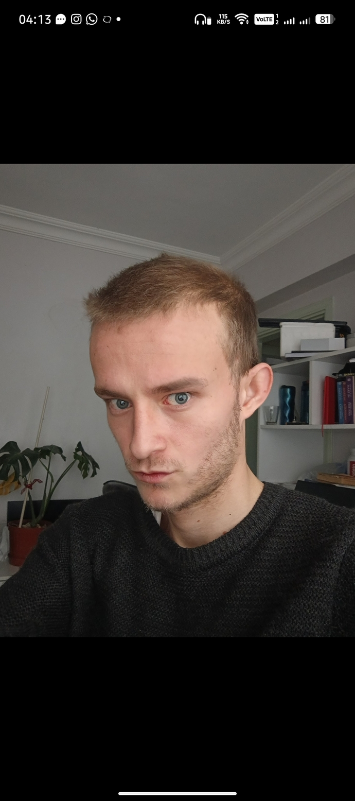 Should I shave my beard or keep growing it?