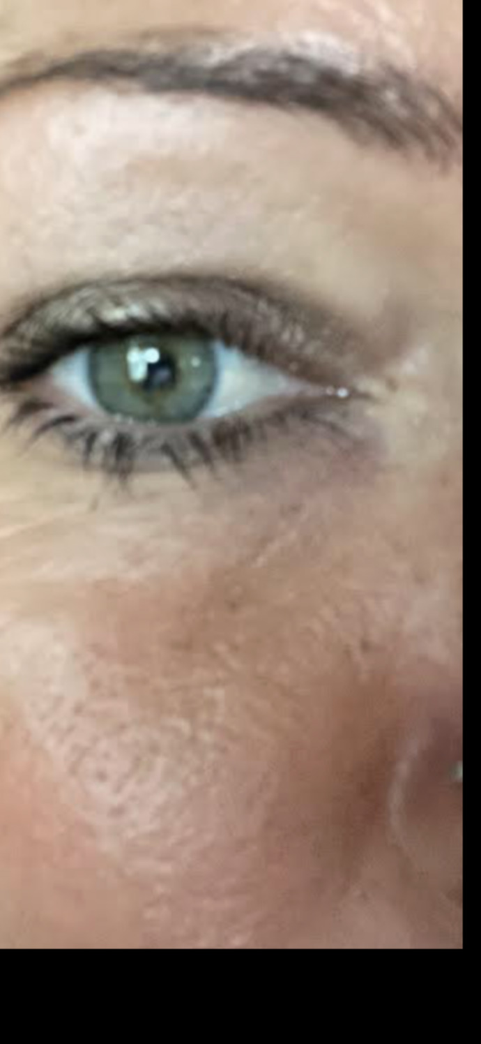 What is your eye color and do you have mixed shades like me?