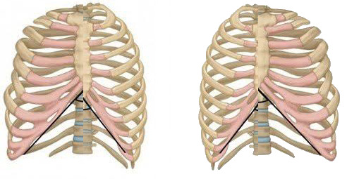 How severe are your asymmetries?