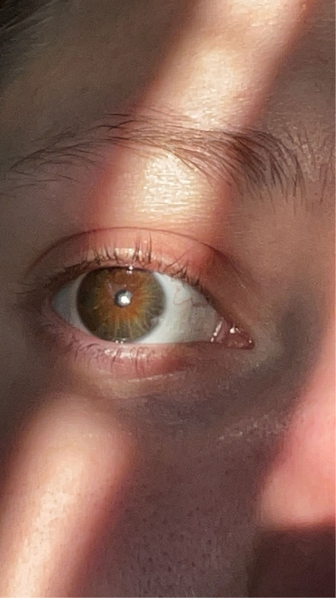 Are my eyes really brown or are they hazel with green hints?