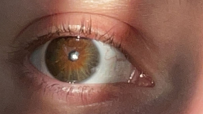 Are my eyes really brown or are they hazel with green hints?