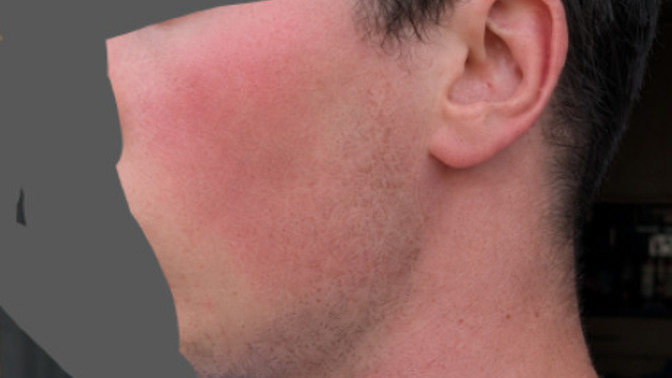 Girls, is it fine if a guy has red cheeks and blushes? Is it a turn off?