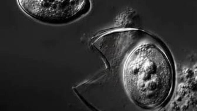 Mexico warns of diarrhea risk when visiting the US. Oh how the tables have turned lmao. What do you guys think of this?