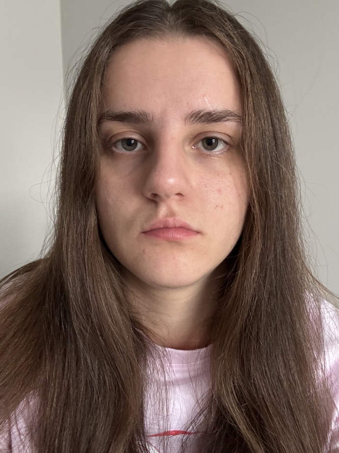 Should I get lip fillers to enhance my natural lips?