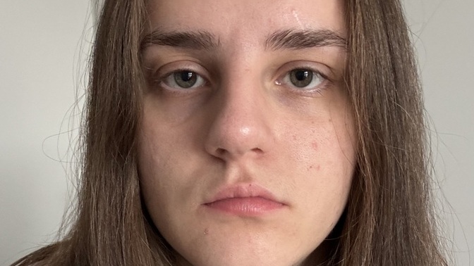 Should I get lip fillers to enhance my natural lips?