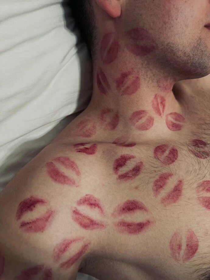 Guys, would you say no to this skincare treatment too?