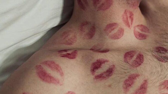 Guys, would you say no to this skincare treatment too?
