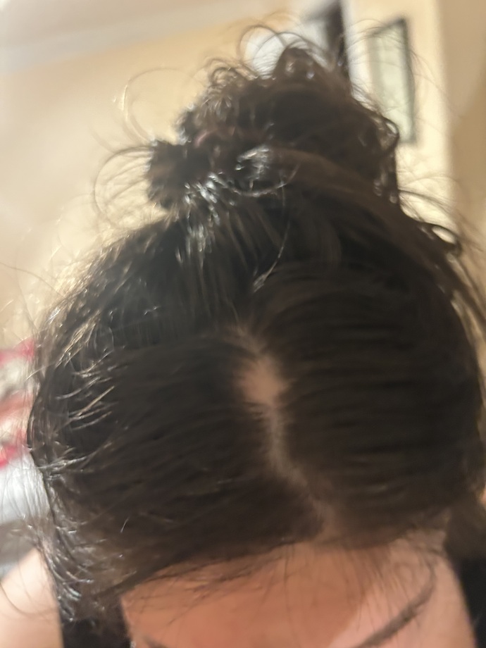 Just washed my hair and found a weird new spot on my scalp—should I worry?