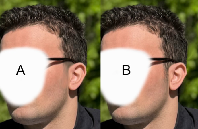 What looks more attractive: a taper fade or regular sideburns?