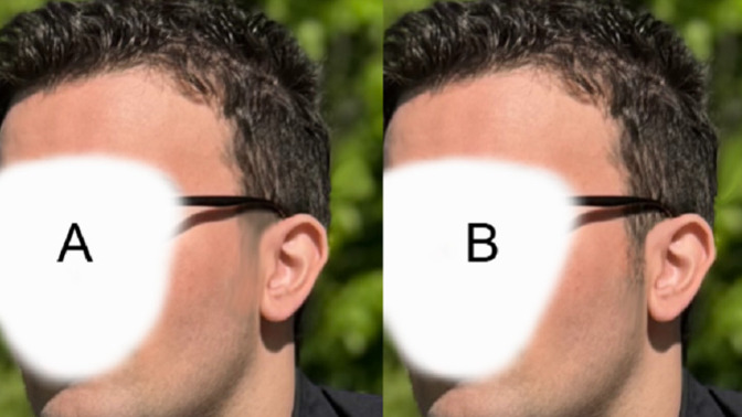 What looks more attractive: a taper fade or regular sideburns?