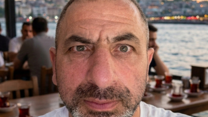 Do I look like I need a hair transplant?