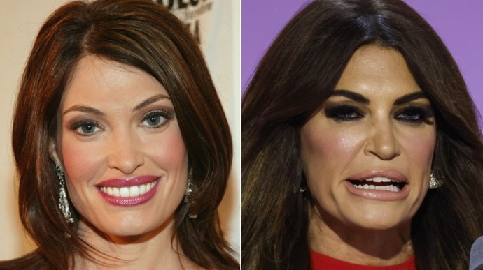 What beauty trend do you think actually makes people look worse?